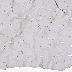 Invitrogen SIGLEC10 Polyclonal Antibody 100 &mu;L; Unconjugated:Antibodies,