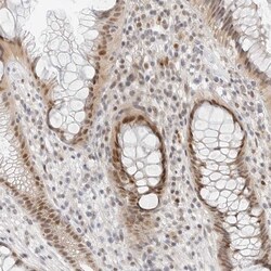 Invitrogen TSEN2 Polyclonal Antibody 100 &mu;L; Unconjugated:Antibodies,