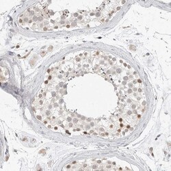 Invitrogen TSEN2 Polyclonal Antibody 100 &mu;L; Unconjugated:Antibodies,