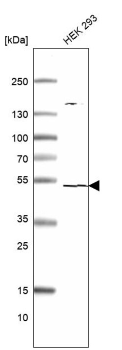 Invitrogen TSEN2 Polyclonal Antibody 100 &mu;L; Unconjugated:Antibodies,
