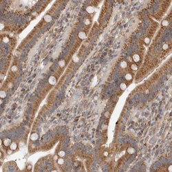 Invitrogen MTFR1L Polyclonal Antibody 100 &mu;L | Buy Online | Invitrogen&trade; | Fisher Scientific