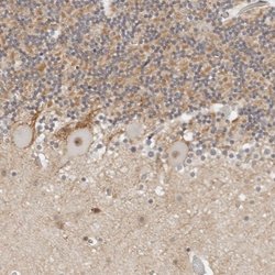 TSEN2 Polyclonal Antibody:Antibodies, Polyclonal