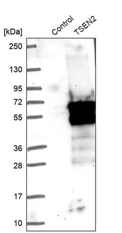 TSEN2 Polyclonal Antibody:Antibodies, Polyclonal