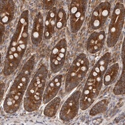 Invitrogen C1orf109 Polyclonal Antibody 100 &mu;L; Unconjugated:Antibodies,