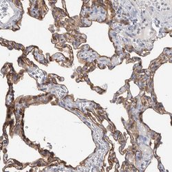 Invitrogen MTFR1L Polyclonal Antibody 100 &mu;L; Unconjugated:Antibodies,