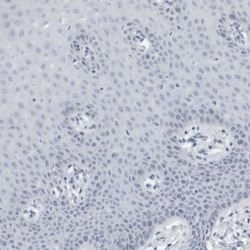 Tenascin R Polyclonal Antibody:Antibodies, Polyclonal