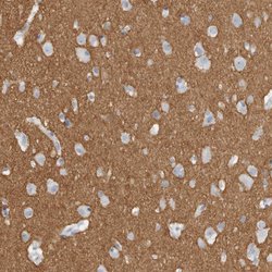 Tenascin R Polyclonal Antibody:Antibodies, Polyclonal