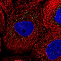 Invitrogen SCP2 Polyclonal Antibody 100 &mu;L; Unconjugated:Antibodies,
