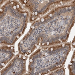 Invitrogen SCP2 Polyclonal Antibody 100 &mu;L; Unconjugated:Antibodies,