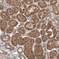 Invitrogen SCP2 Polyclonal Antibody 100 &mu;L; Unconjugated:Antibodies,
