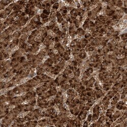Invitrogen SCP2 Polyclonal Antibody 100 &mu;L; Unconjugated:Antibodies,