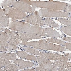Invitrogen SCP2 Polyclonal Antibody 100 &mu;L; Unconjugated:Antibodies,