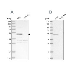 Invitrogen SCP2 Polyclonal Antibody 100 &mu;L; Unconjugated:Antibodies,