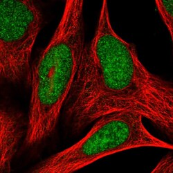ADPRHL2 Polyclonal Antibody:Antibodies, Polyclonal
