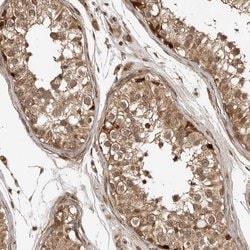 ADPRHL2 Polyclonal Antibody:Antibodies, Polyclonal