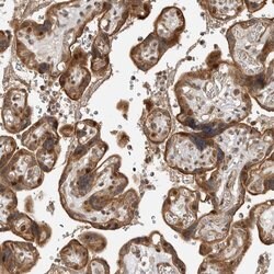 ADPRHL2 Polyclonal Antibody:Antibodies, Polyclonal