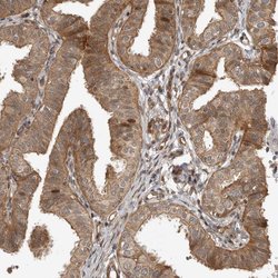 ADPRHL2 Polyclonal Antibody:Antibodies, Polyclonal