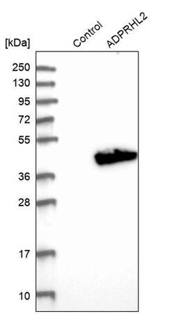 ADPRHL2 Polyclonal Antibody:Antibodies, Polyclonal