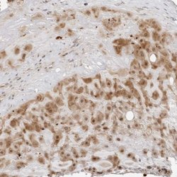Invitrogen RNF146 Polyclonal Antibody 100 &mu;L; Unconjugated:Antibodies,