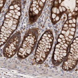 Invitrogen MRPL41 Polyclonal Antibody 100 &mu;L; Unconjugated:Antibodies,
