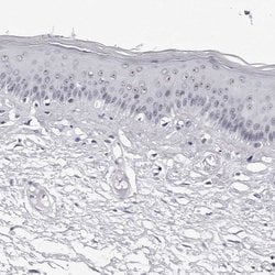 Invitrogen GNL2 Polyclonal Antibody 100 &mu;L | Buy Online | Invitrogen&trade; | Fisher Scientific