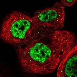 Invitrogen RBM6 Polyclonal Antibody 100 &mu;L; Unconjugated:Antibodies,