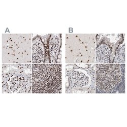 Invitrogen RBM6 Polyclonal Antibody 100 &mu;L; Unconjugated:Antibodies,
