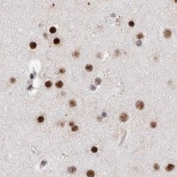 Invitrogen RBM6 Polyclonal Antibody 100 &mu;L; Unconjugated:Antibodies,