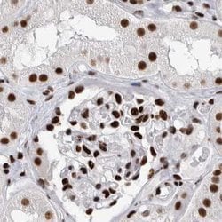Invitrogen RBM6 Polyclonal Antibody 100 &mu;L; Unconjugated:Antibodies,