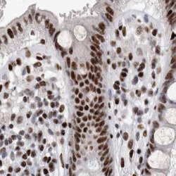 Invitrogen RBM6 Polyclonal Antibody 100 &mu;L; Unconjugated:Antibodies,