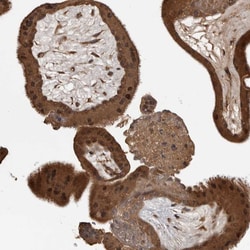 Invitrogen AKAP7 Polyclonal Antibody 100 &mu;L; Unconjugated:Antibodies,
