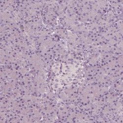 Invitrogen C6orf97 Polyclonal Antibody 100 &mu;L | Buy Online | Invitrogen&trade; | Fisher Scientific