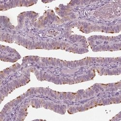 Invitrogen C6orf97 Polyclonal Antibody 100 &mu;L | Buy Online | Invitrogen&trade; | Fisher Scientific