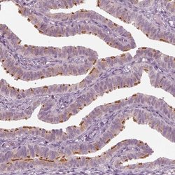 Invitrogen C6orf97 Polyclonal Antibody 100 &mu;L | Buy Online | Invitrogen&trade; | Fisher Scientific