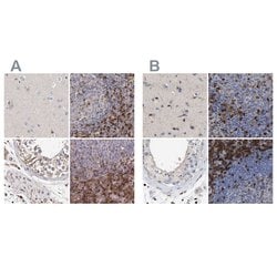 GIMAP4 Polyclonal Antibody:Antibodies, Polyclonal