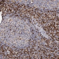 GIMAP4 Polyclonal Antibody:Antibodies, Polyclonal