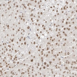 Invitrogen SPIDR Polyclonal Antibody 100 &mu;L | Buy Online | Invitrogen&trade; | Fisher Scientific