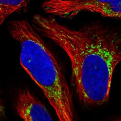 Invitrogen RT28 Polyclonal Antibody 100 &mu;L; Unconjugated:Antibodies,