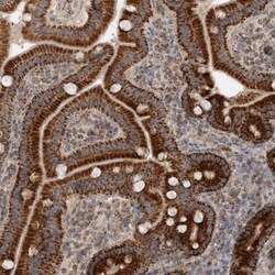 Invitrogen RT28 Polyclonal Antibody 100 &mu;L; Unconjugated:Antibodies,