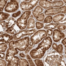 Invitrogen DCAF8 Polyclonal Antibody 100 &mu;L | Buy Online | Invitrogen&trade; | Fisher Scientific