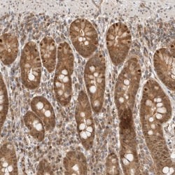 Invitrogen DCAF8 Polyclonal Antibody 100 &mu;L | Buy Online | Invitrogen&trade; | Fisher Scientific