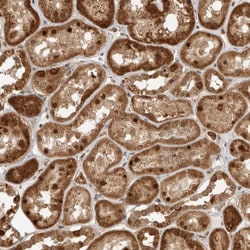 Invitrogen DCAF8 Polyclonal Antibody 100 &mu;L | Buy Online | Invitrogen&trade; | Fisher Scientific