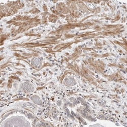 STXBP3 Polyclonal Antibody 100 &mu;L | Buy Online | Thermo Scientific | Fisher Scientific