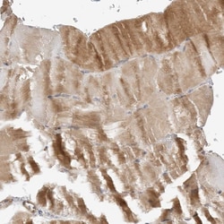 STXBP3 Polyclonal Antibody 100 &mu;L | Buy Online | Thermo Scientific | Fisher Scientific