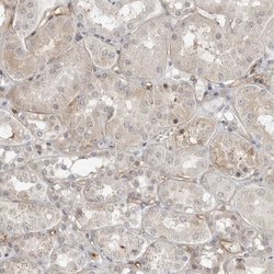 STXBP3 Polyclonal Antibody 100 &mu;L | Buy Online | Thermo Scientific | Fisher Scientific