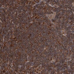 Invitrogen ADCK4 Polyclonal Antibody 100 &mu;L | Buy Online | Invitrogen&trade; | Fisher Scientific