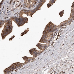 Invitrogen ADCK4 Polyclonal Antibody 100 &mu;L | Buy Online | Invitrogen&trade; | Fisher Scientific