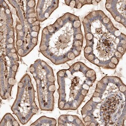 Invitrogen ADCK4 Polyclonal Antibody 100 &mu;L | Buy Online | Invitrogen&trade; | Fisher Scientific