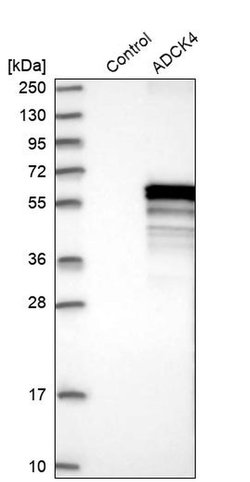 Invitrogen ADCK4 Polyclonal Antibody 100 &mu;L | Buy Online | Invitrogen&trade; | Fisher Scientific