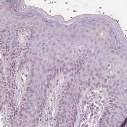 Invitrogen ERICH5 Polyclonal Antibody 100 &mu;L; Unconjugated:Antibodies,